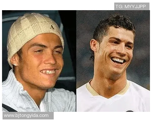 足球明星正畸全过程揭秘与精彩瞬间汇总视频合集 足球明星正畸全过程揭秘与精彩瞬间汇总视频合集